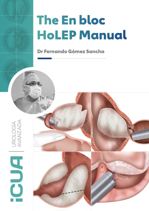 The En bloc HoLEP Manual