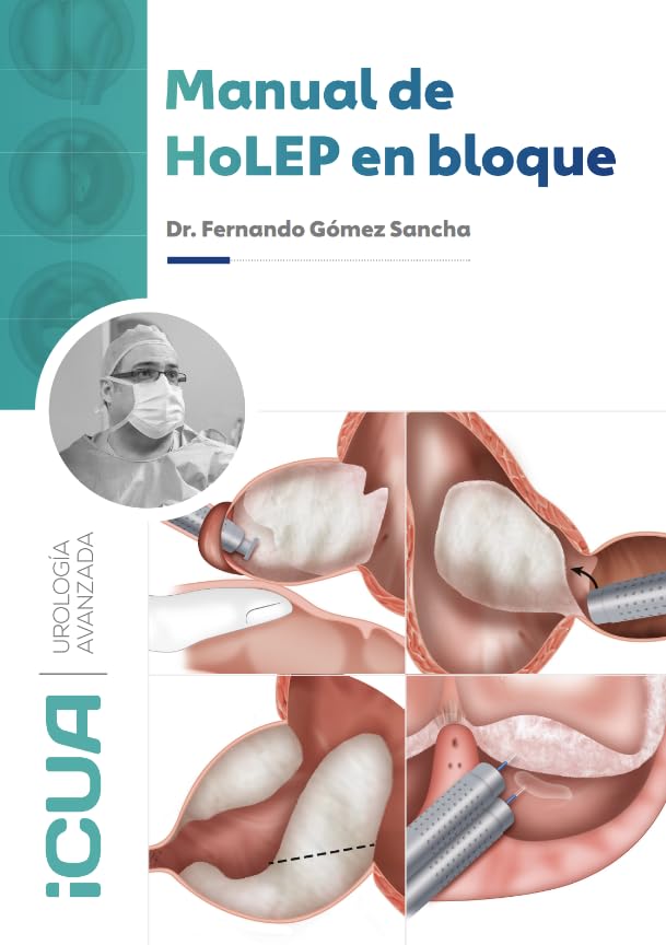Manual de HoLEP en bloque