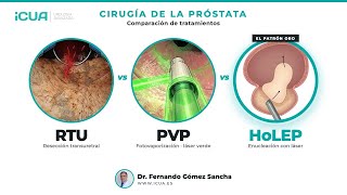 RTU vs Láser Verde (PVP) vs HoLEP: ¿qué cirugía elegir?