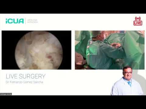 HoLEP live session with 2 cases
