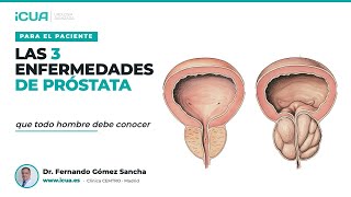Las 3 enfermedades de la próstata que todo hombre debe conocer