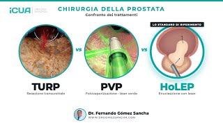 TURP vs Laser Verde vs HoLEP: quale intervento scegliere?