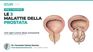 Le 3 malattie della prostata che ogni uomo deve conoscere