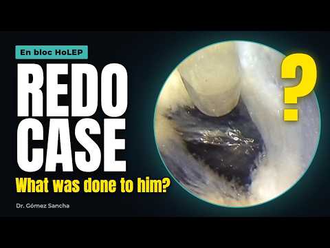 Redo case: what was done to this patient before?