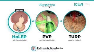 TURP مقابل GreenLight مقابل HoLEP: أي عملية تختار؟