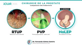 RTUP vs Laser Vert vs HoLEP : quelle chirurgie choisir ?