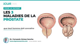 Les 3 maladies de la prostate que tout homme doit connaître