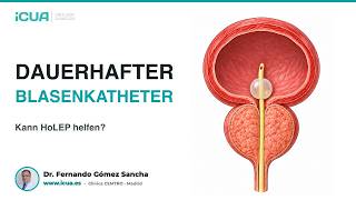Dauerkatheter bei vergrößerter Prostata: Wann kann HoLEP helfen?
