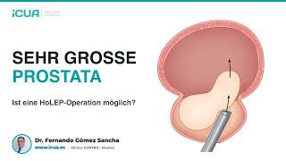 Sehr große Prostata: Ist eine HoLEP-Operation möglich?