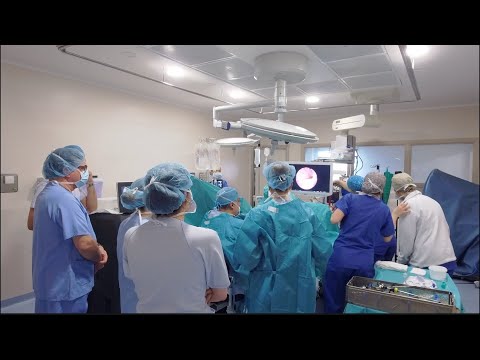 RL HoLEP: A nice teaching case, showing the movements of the hand of the surgeon, difficult plane.
