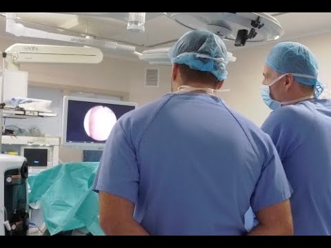 RL HoLEP Videos: 190 cc prostate, Re-do operation with a huge subtrigonal nodule