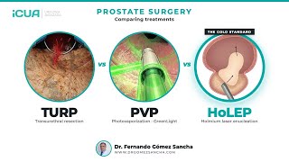 TURP vs GreenLight Laser vs HoLEP: Which Surgery to Pick?