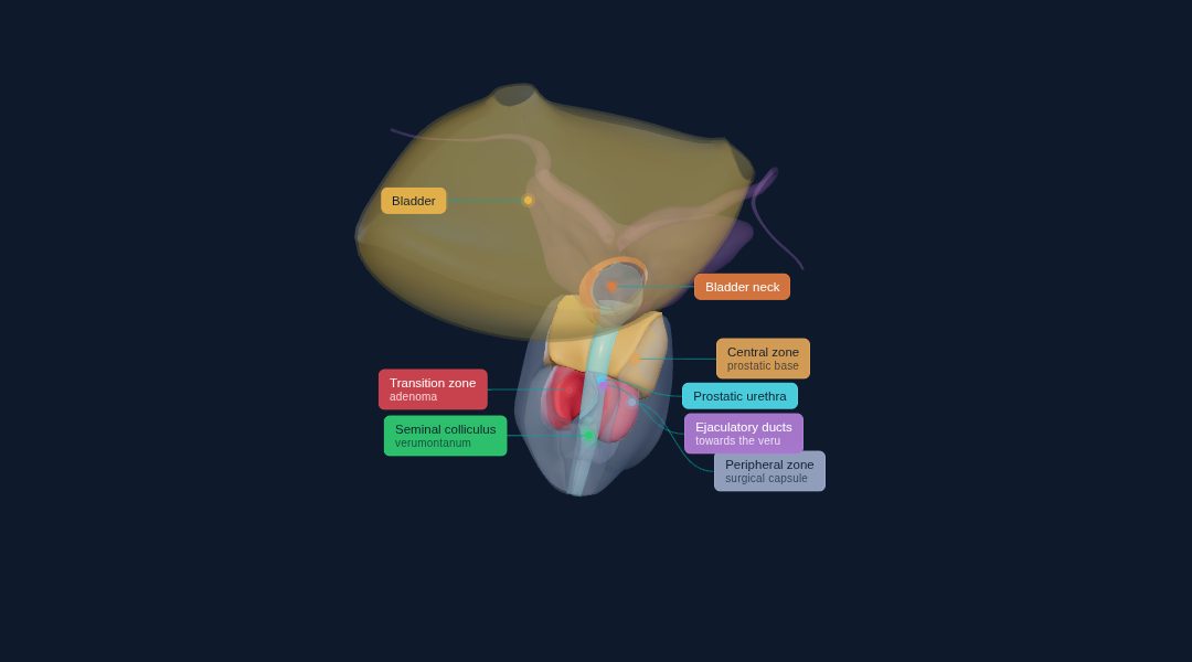 Interactive 3D model of the prostate and bladder