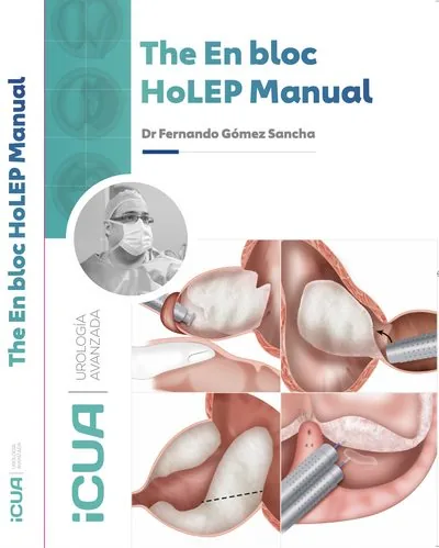 Cover of The En Bloc HoLEP Manual by Dr Fernando Gómez Sancha