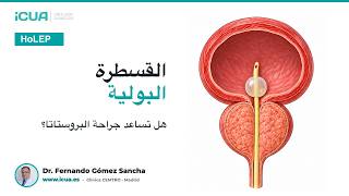 القسطرة البولية وتضخم البروستاتا: متى قد تساعد عملية HoLEP؟