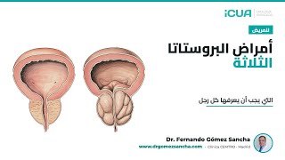 الأمراض الثلاثة للبروستاتا التي يجب أن يعرفها كل رجل (د. غوميز سانشا)