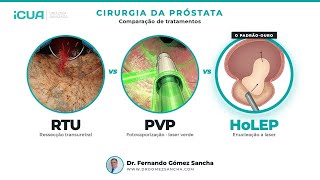 RTU vs Laser Verde vs HoLEP: qual cirurgia escolher?