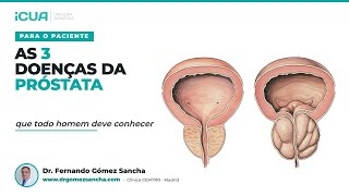 As 3 doenças da próstata que todo homem deve conhecer