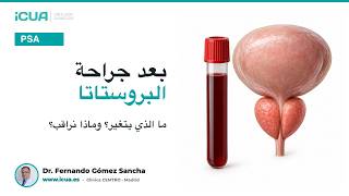 تحليل PSA بعد جراحة البروستاتا: كيف تفهم النتيجة؟
