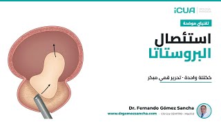 شرح تقنيتيعملية البروستاتا بالكتلة الكاملة مع التحرير القمي المبكر —