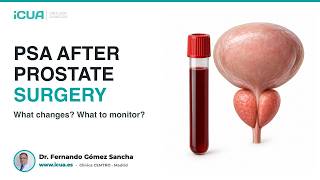 PSA after prostate surgery: what does your result mean?